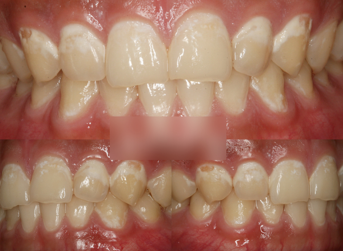 Treatment case image 1