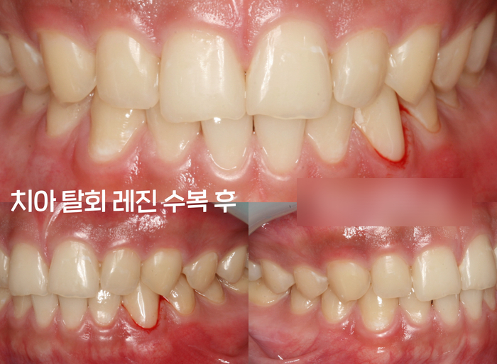 Treatment case image 3