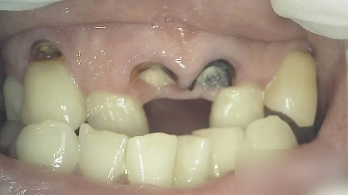 Treatment case image 1