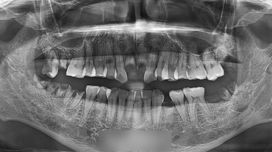 Treatment case image 2