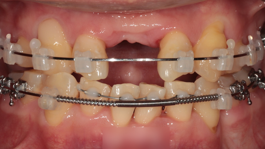 Treatment case image 5