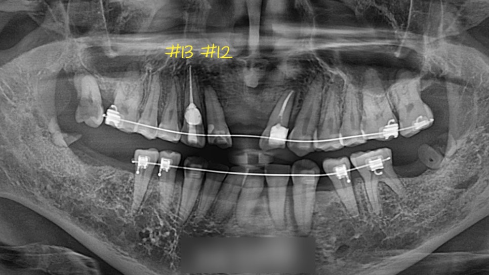 Treatment case image 6