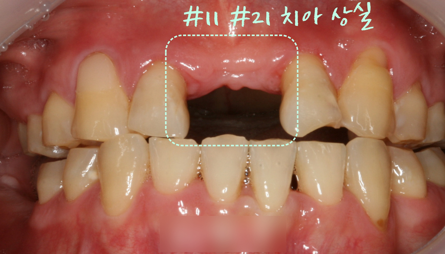 Treatment case image 7