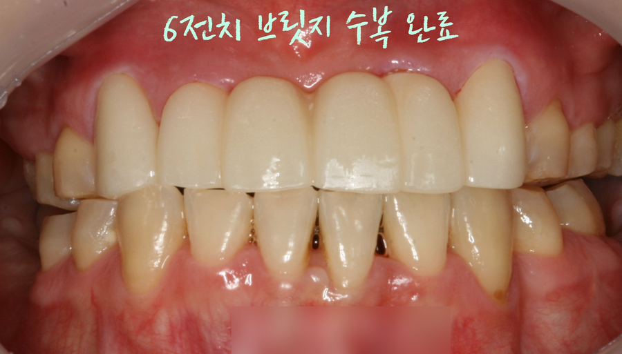 Treatment case image 8