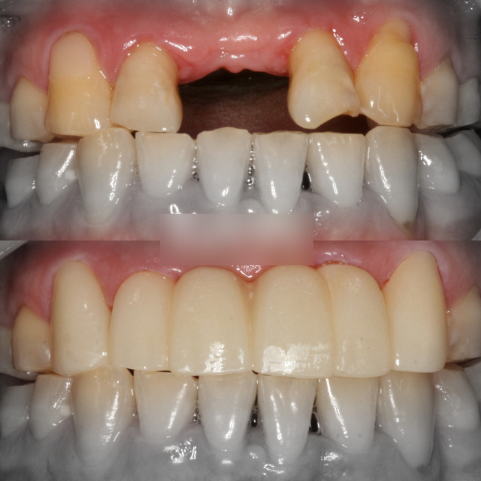 Treatment case image 9