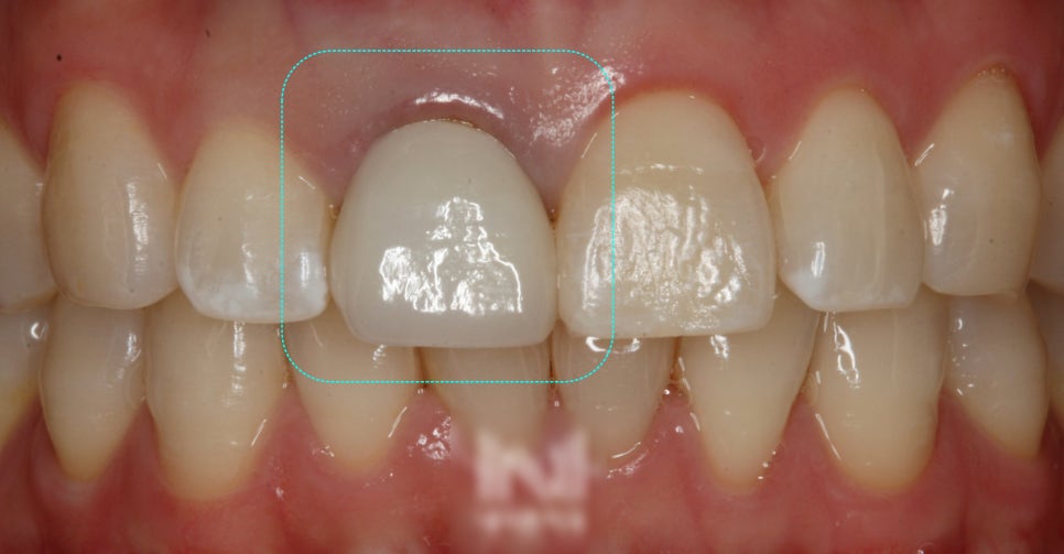 Treatment case image 1