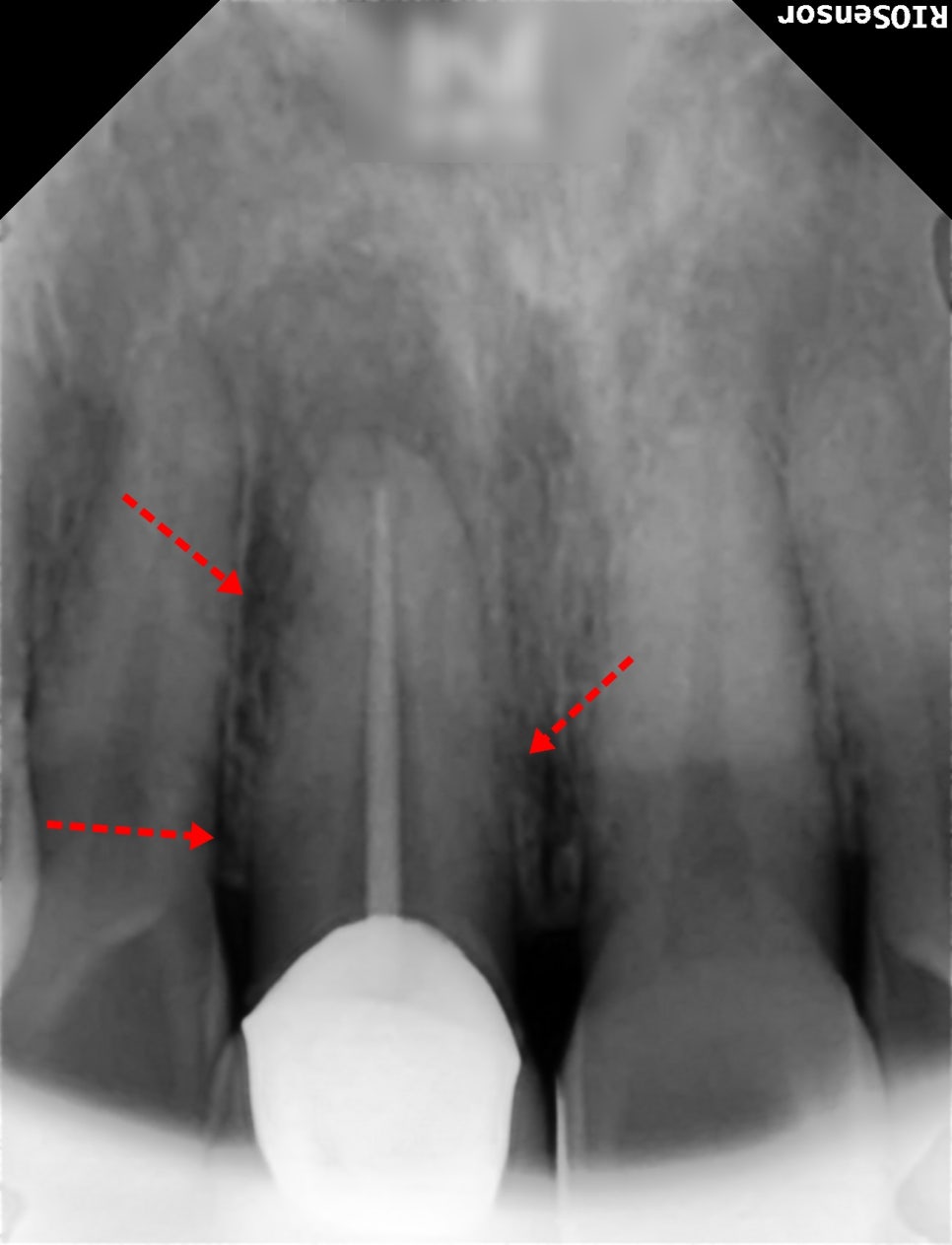 Treatment case image 2