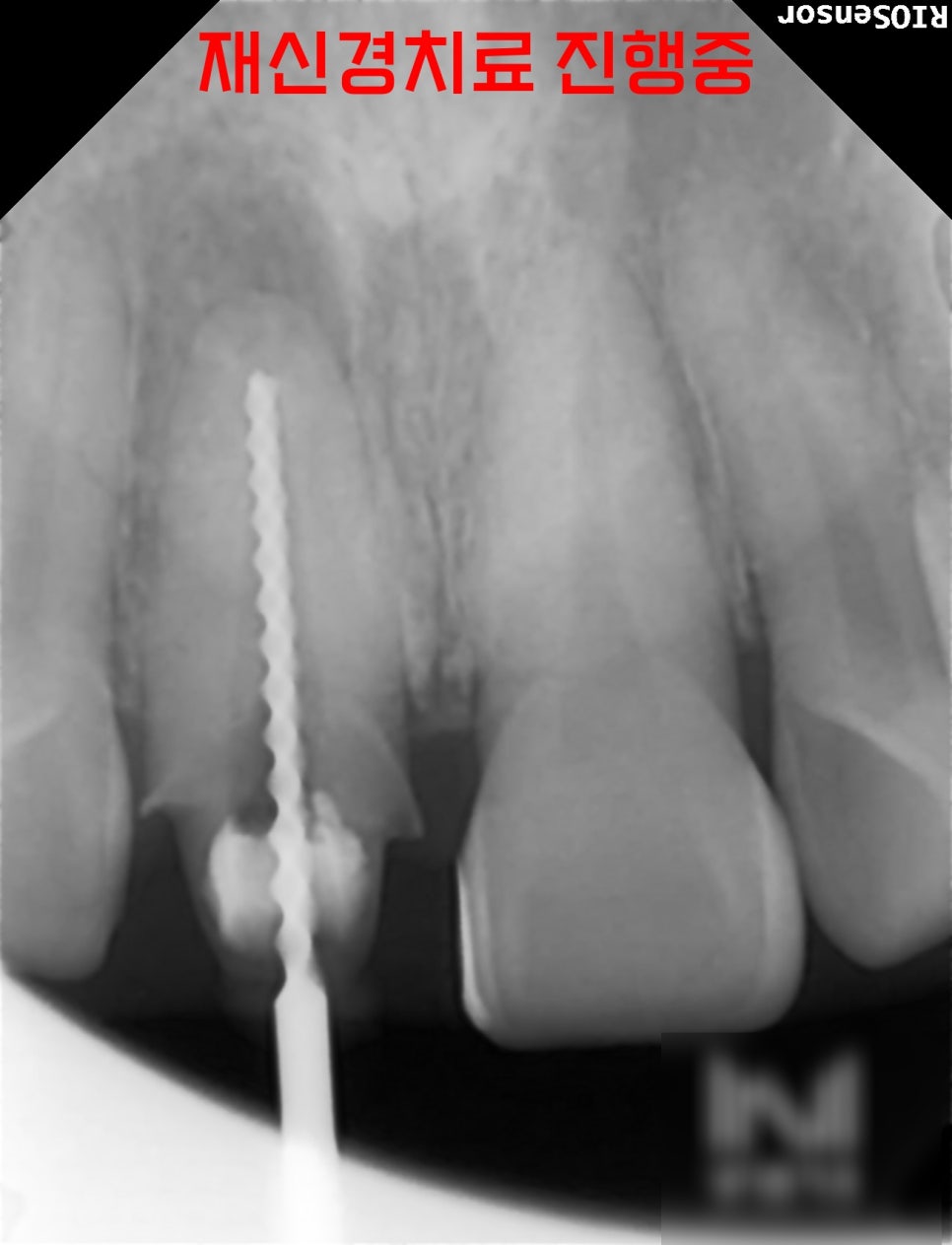Treatment case image 4