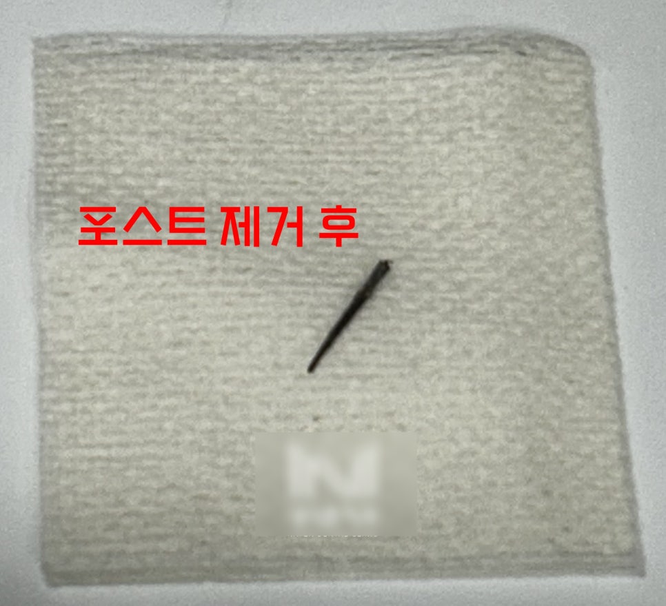 Treatment case image 5