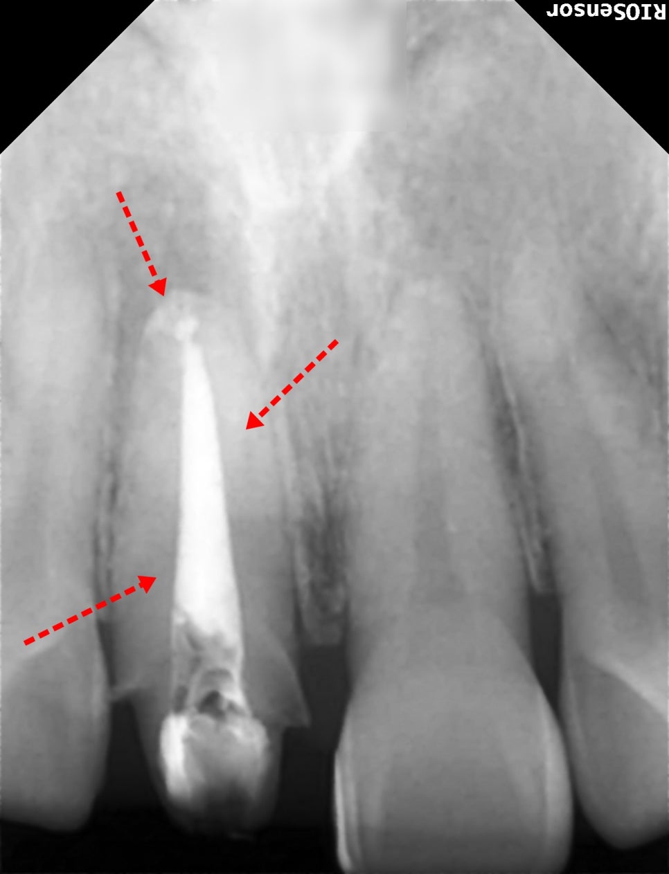 Treatment case image 8