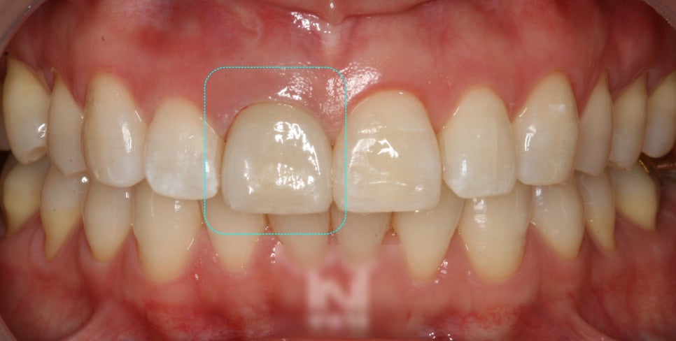 Treatment case image 9
