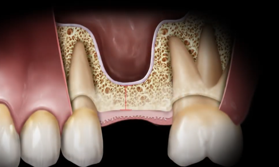 Treatment case image 1