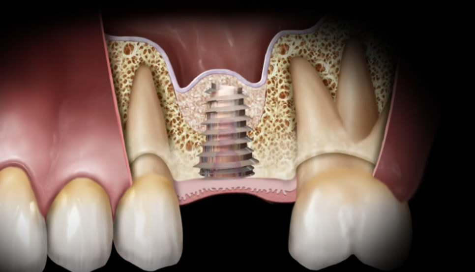 Treatment case image 2
