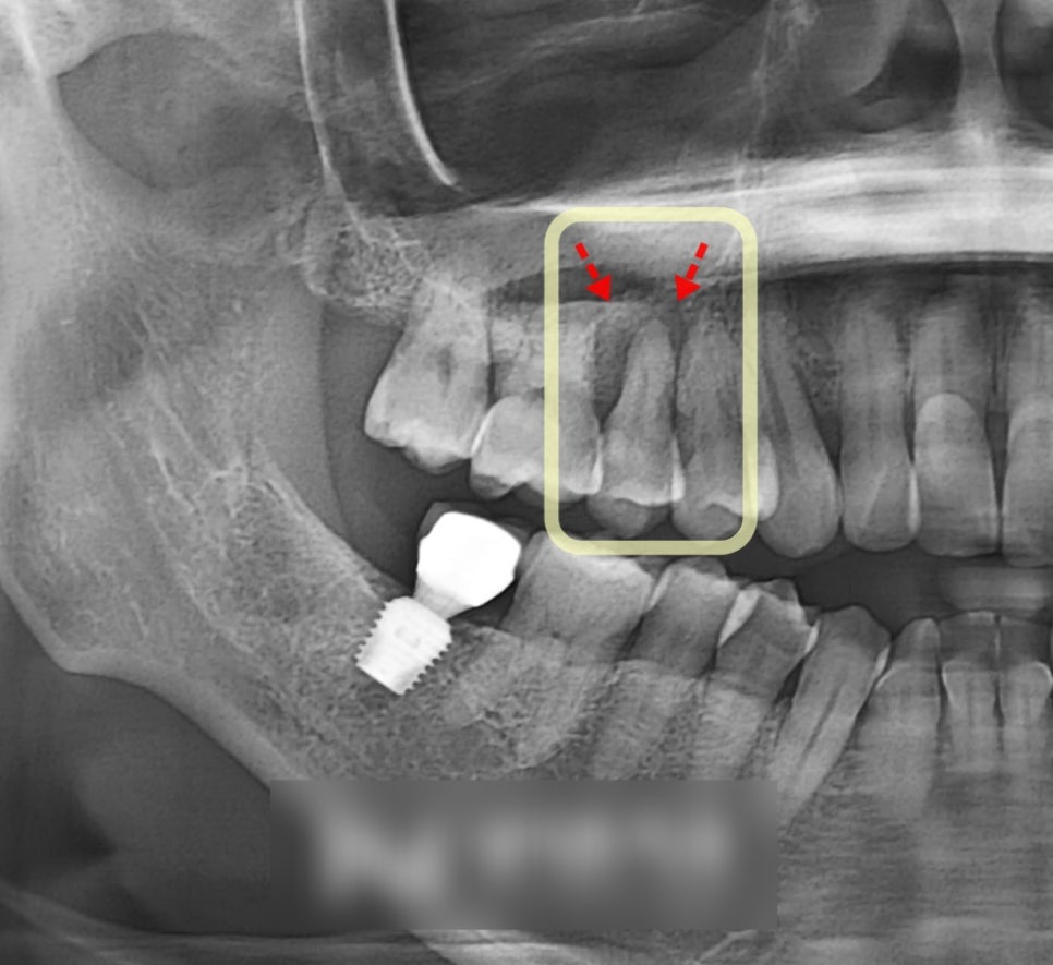 Treatment case image 3