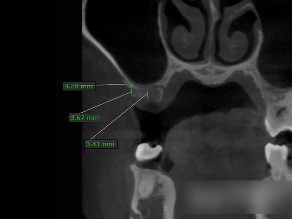 Treatment case image 4