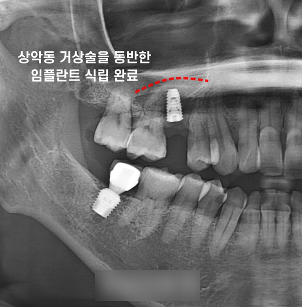 Treatment case image 5