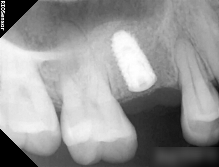 Treatment case image 6