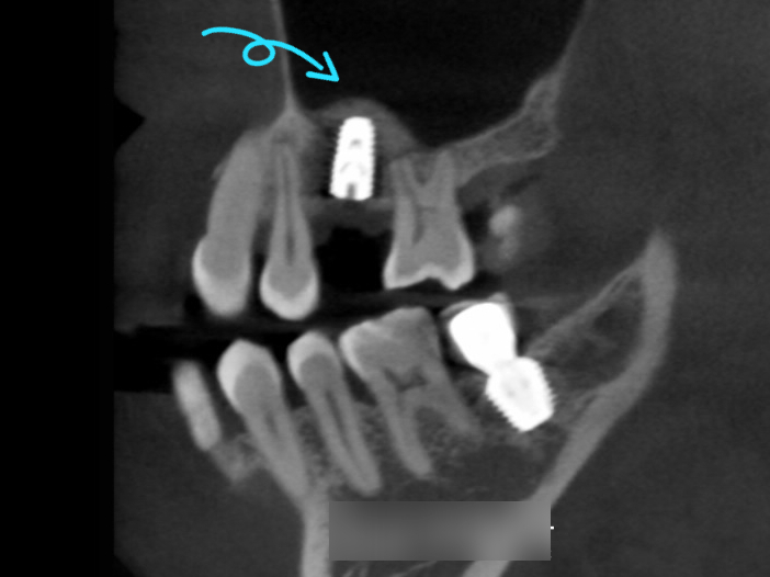 Treatment case image 7