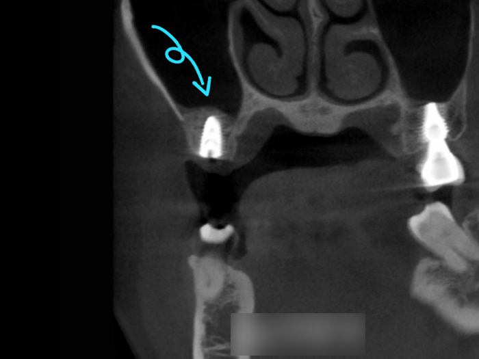 Treatment case image 8