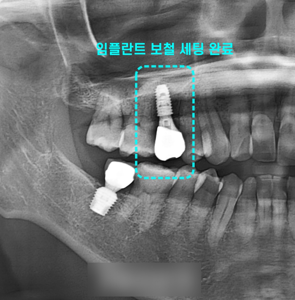Treatment case image 13