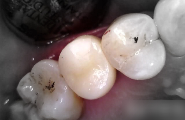 Treatment case image 15