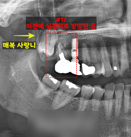 Treatment case image 1