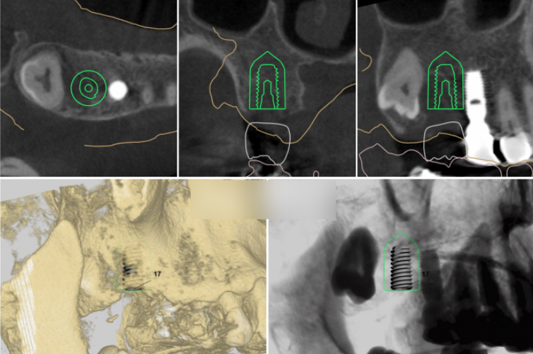 Treatment case image 4