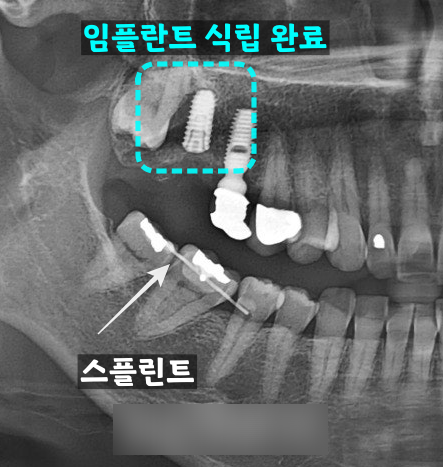 Treatment case image 5