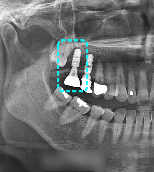 Treatment case image 9