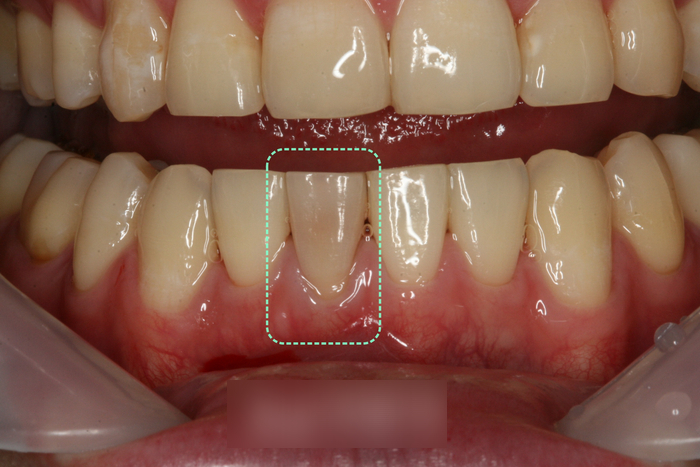 Treatment case image 1