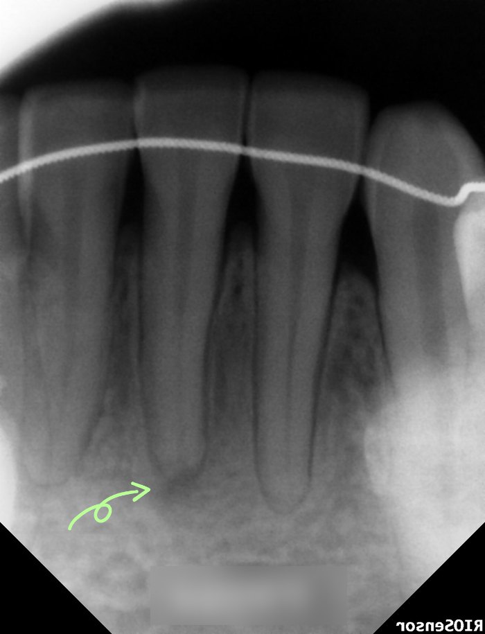 Treatment case image 2