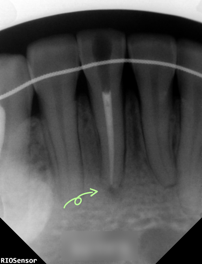 Treatment case image 5