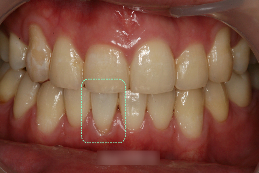 Treatment case image 6