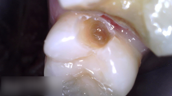Treatment case image 1
