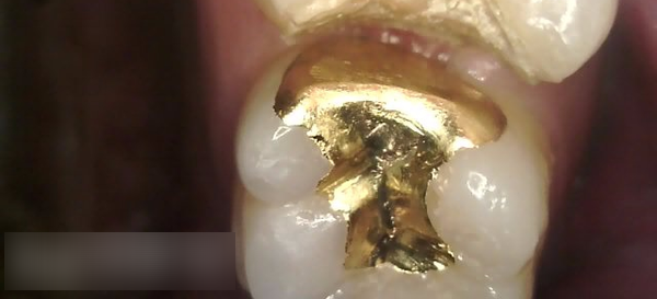 Treatment case image 3