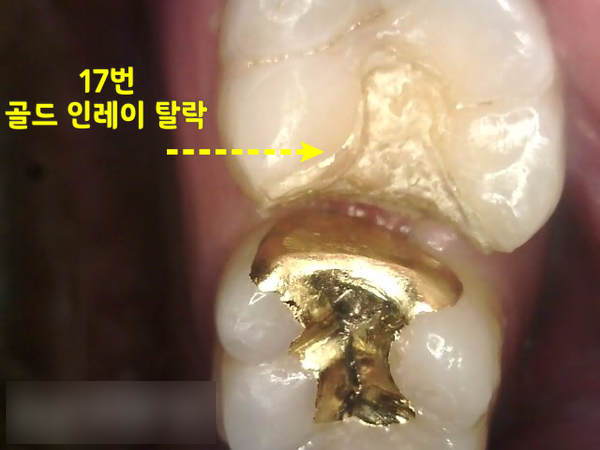 Treatment case image 4