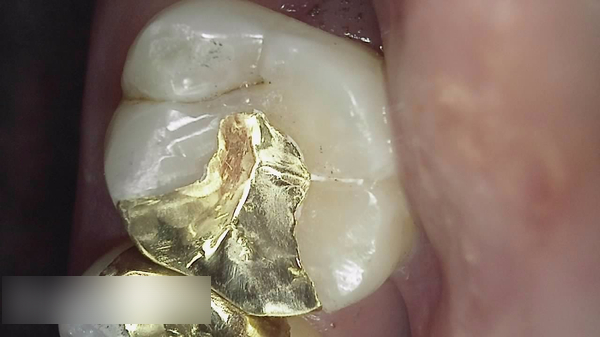Treatment case image 5