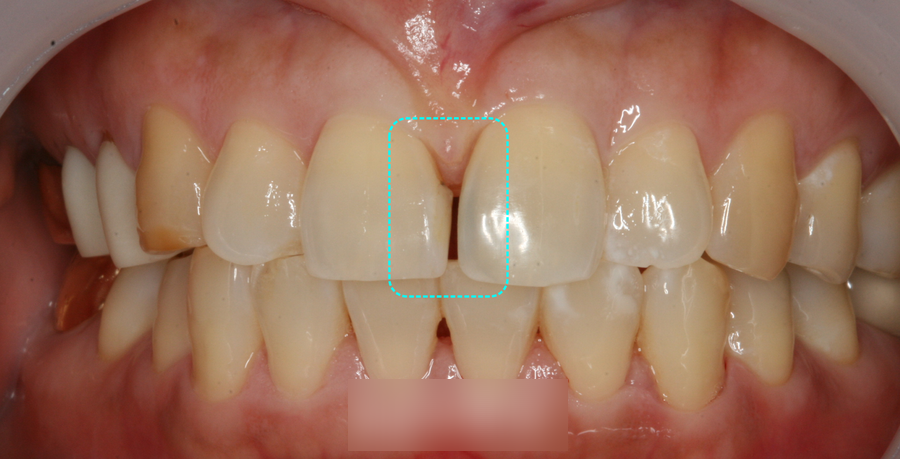 Treatment case image 1