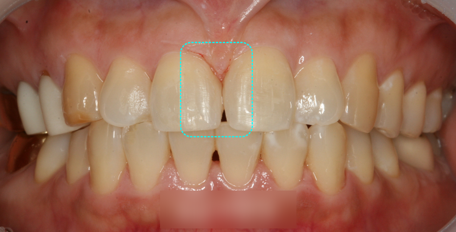 Treatment case image 3