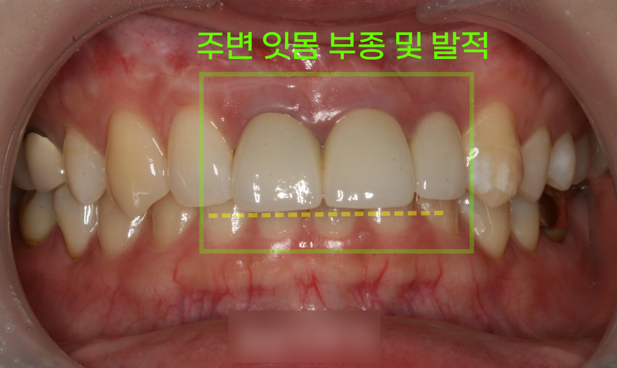 Treatment case image 1