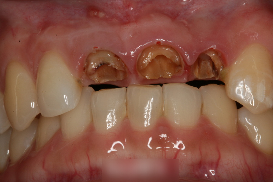 Treatment case image 3