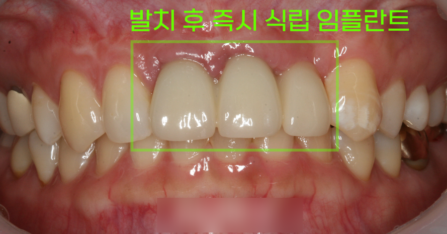 Treatment case image 5