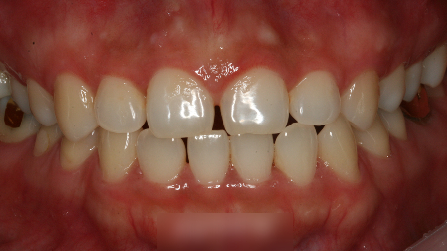 Treatment case image 1
