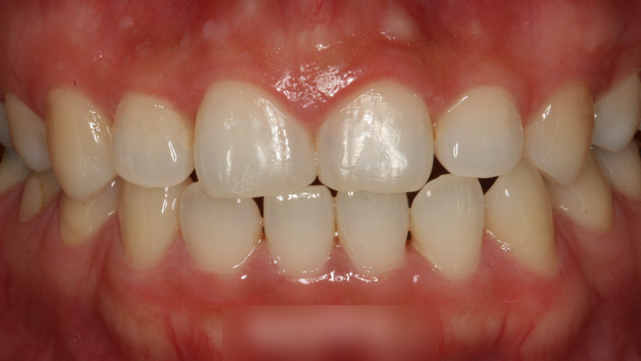 Treatment case image 3