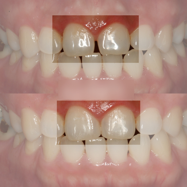Treatment case image 4