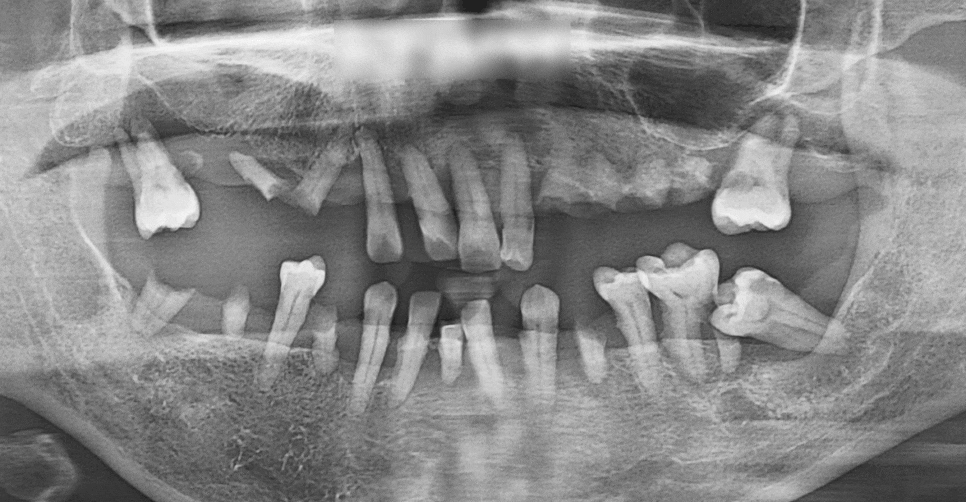 Treatment case image 1