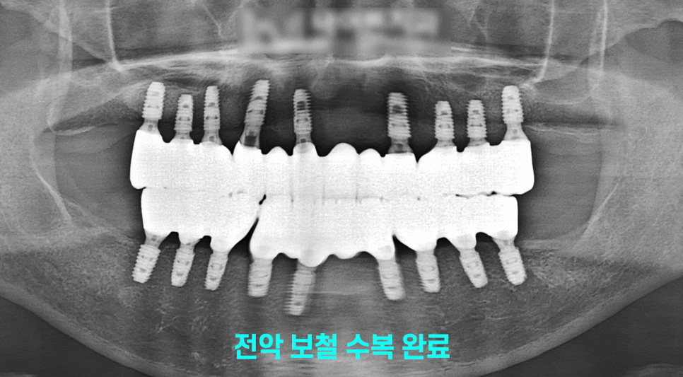 Treatment case image 3