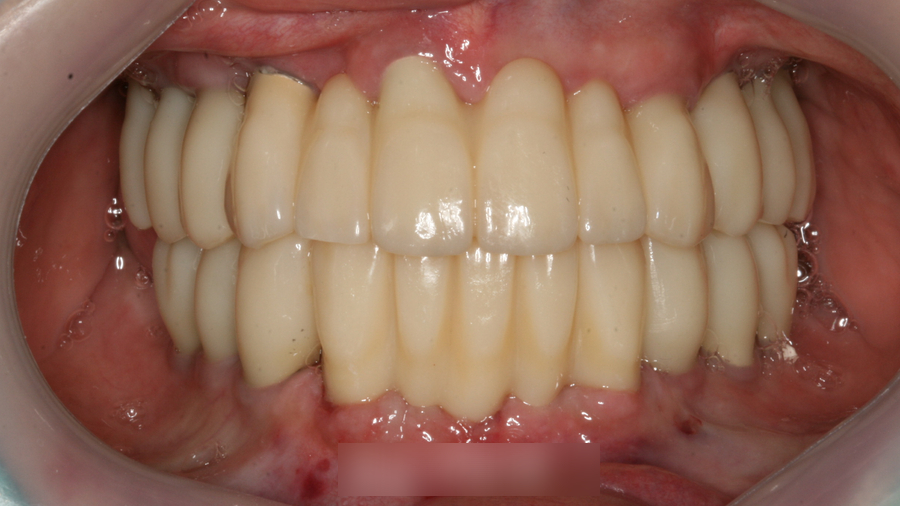 Treatment case image 5