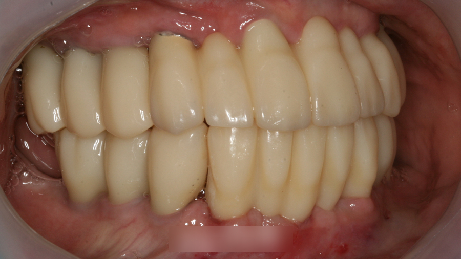 Treatment case image 6