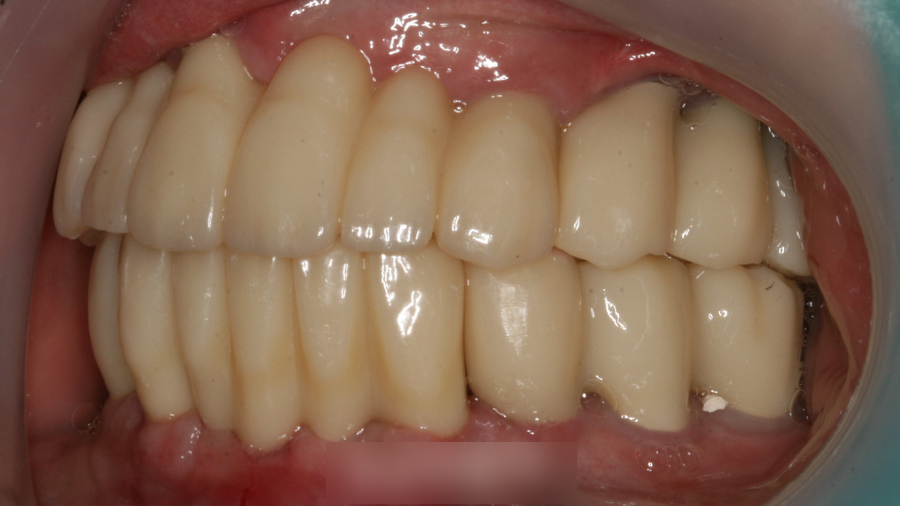 Treatment case image 7